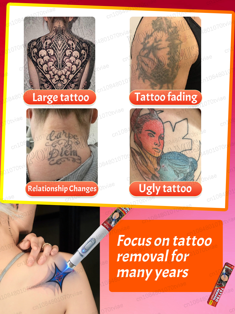 Nano laser tattooʀᴇᴍᴏᴠᴀʟ ᴘᴇɴ:  - Laser Toner Powder 리뷰 및 가격